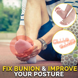 Orthopedic Bunion Alignment Corrector